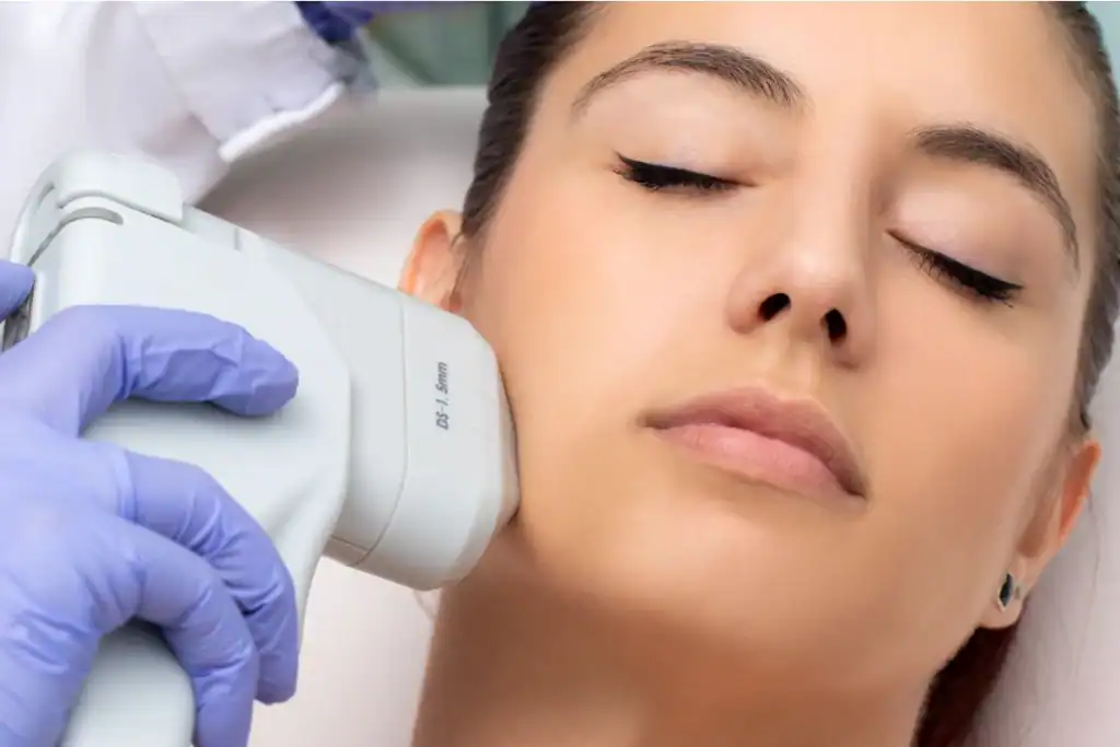 Discover the Perfect Duo: RF Microneedling and HIFU 2 Image of Morpheus8 And HIFU Combined with Lipo 360 Southend-on-Sea