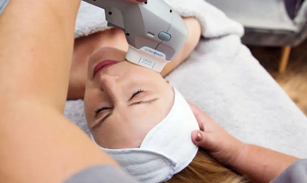 Discover the Perfect Duo: RF Microneedling and HIFU 1 Image of Morpheus8 And HIFU Southend-on-Sea combined treatment
